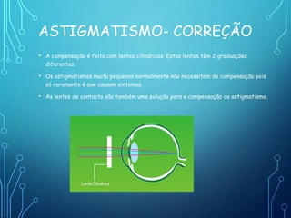 ASTIGMATISMO- CORREÇÃO
• A compensação é feita com lentes cilíndricas. Estas lentes têm 2 graduações
diferentes.
• Os astigmatismos muito pequenos normalmente não necessitam de compensação pois
só raramente é que causam sintomas.
• As lentes de contacto são também uma solução para a compensação do astigmatismo.
 