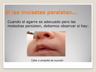 Si las molestas persisten…
Cuando el agarre es adecuado pero las
molestias persisten, debemos observar si hay:
Callo o ampolla de succión
 