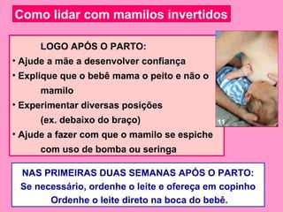 Como lidar com mamilos invertidos

      LOGO APÓS O PARTO:
• Ajude a mãe a desenvolver confiança
• Explique que o bebê mama o peito e não o
      mamilo
• Experimentar diversas posições
      (ex. debaixo do braço)                  11
• Ajude a fazer com que o mamilo se espiche
      com uso de bomba ou seringa

 NAS PRIMEIRAS DUAS SEMANAS APÓS O PARTO:
 Se necessário, ordenhe o leite e ofereça em copinho
       Ordenhe o leite direto na boca do bebê.
 