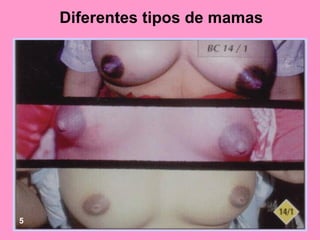 Diferentes tipos de mamas




5
 