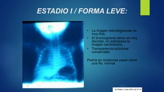 ESTADIO I / FORMA LEVE:
• La imagen reticulogranular es
muy fina.
• El broncograma aéreo es muy
discreto, no sobrepasa la
imagen cardiotimica.
• Transparencia pulmonar
conservada.
Podría en ocasiones pasar como
una Rx. normal.
 