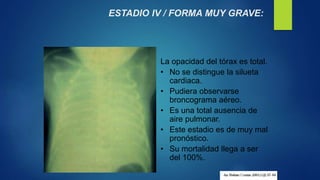 ESTADIO IV / FORMA MUY GRAVE:
La opacidad del tórax es total.
• No se distingue la silueta
cardiaca.
• Pudiera observarse
broncograma aéreo.
• Es una total ausencia de
aire pulmonar.
• Este estadio es de muy mal
pronóstico.
• Su mortalidad llega a ser
del 100%.
 