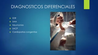DIAGNOSTICOS DIFERENCIALES
 SDR
 SAM
 Neumonias
 SACP
 Cardiopatias congenitas
 