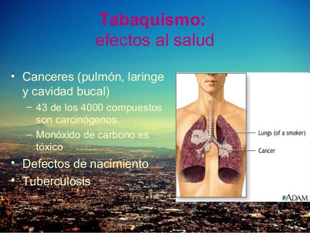 El preparado la barrera el productor