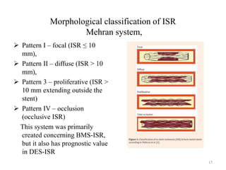 Morphological classification of ISR
Mehran system,
 Pattern I – focal (ISR ≤ 10
mm),
 Pattern II – diffuse (ISR > 10
mm),
 Pattern 3 – proliferative (ISR >
10 mm extending outside the
stent)
 Pattern IV – occlusion
(occlusive ISR)
This system was primarily
created concerning BMS-ISR,
but it also has prognostic value
in DES-ISR
17
 