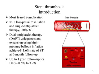 Stent thrombosis
Introduction
 Most feared complication
 with low-pressure inflation
and single-antiplatelet
therapy, 20% ST
 Dual-antiplatelet therapy
(DAPT) ,adequate stent
expansion using high-
pressure balloon inflation
achieved 1.6% rate of ST
at 6-month follow-up
 Up to 1 year follow-up for
DES - 0.6% to 3.2%
2
 