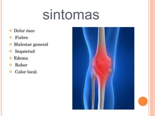 sintomas Dolor óseo Fiebre Malestar general Inquietud Edema Rubor Calor local.  