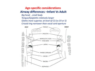 Age-specific considerations
Airway differences –Infant Vs Adult
Big head , small body
Tongue/Epiglottis relatively larger
Glottis more superior, at level of C3 (vs C4 or 5)
Cricoid ring narrower than vocal cord aperture
 