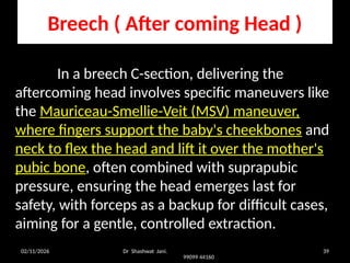PROBLEM OF DELIVERING FETAL HEAD DURING CESAREAN SECTION BY DR SHASHWAT ...