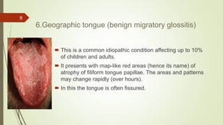 Problems associated with oral cavity | PPTX