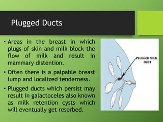 problemsinbreastfeeding-210808062603.pdf
