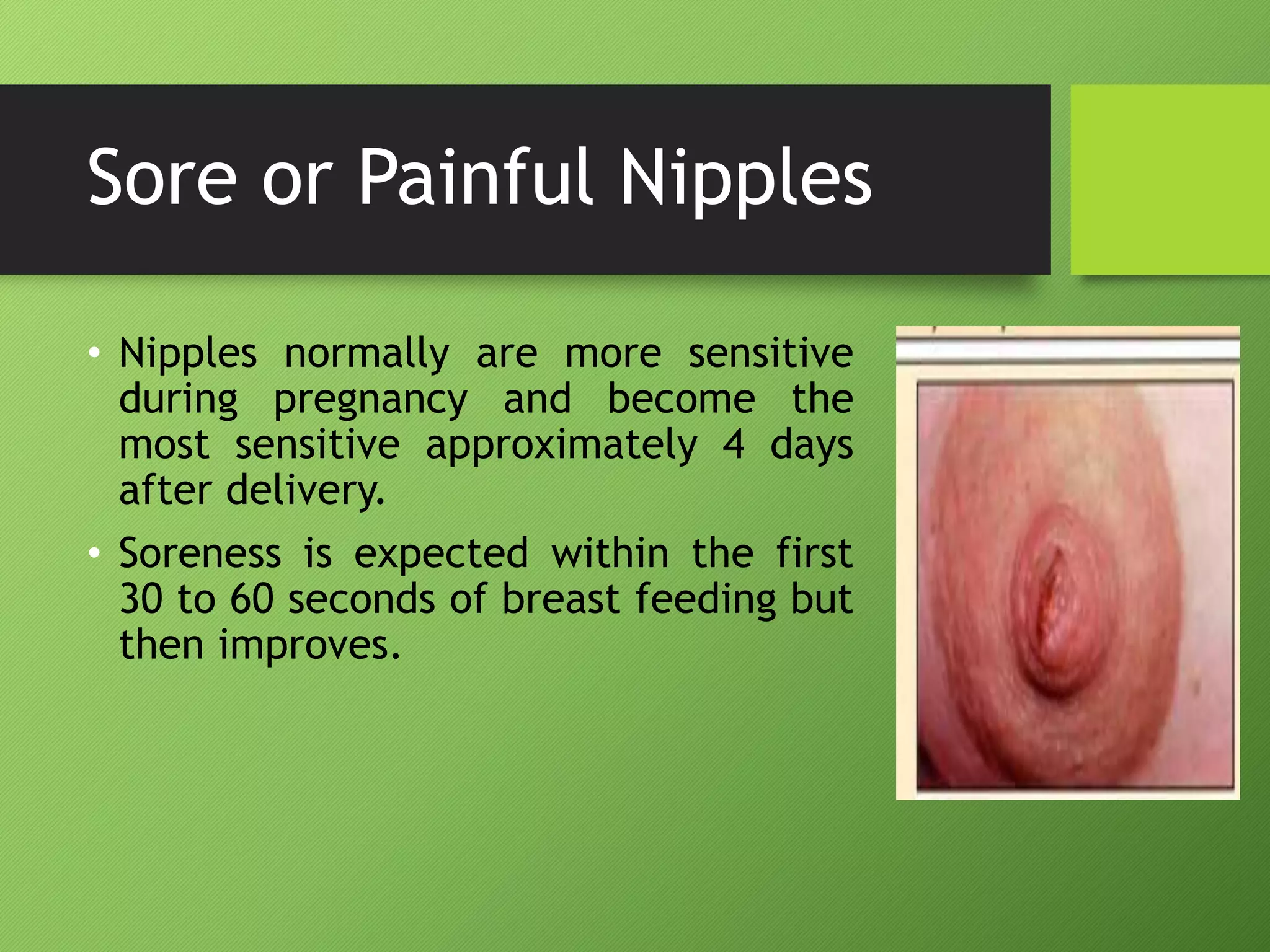 Sore or Painful Nipples
• Nipples normally are more sensitive
during pregnancy and become the
most sensitive approximately 4 days
after delivery.
• Soreness is expected within the first
30 to 60 seconds of breast feeding but
then improves.
 