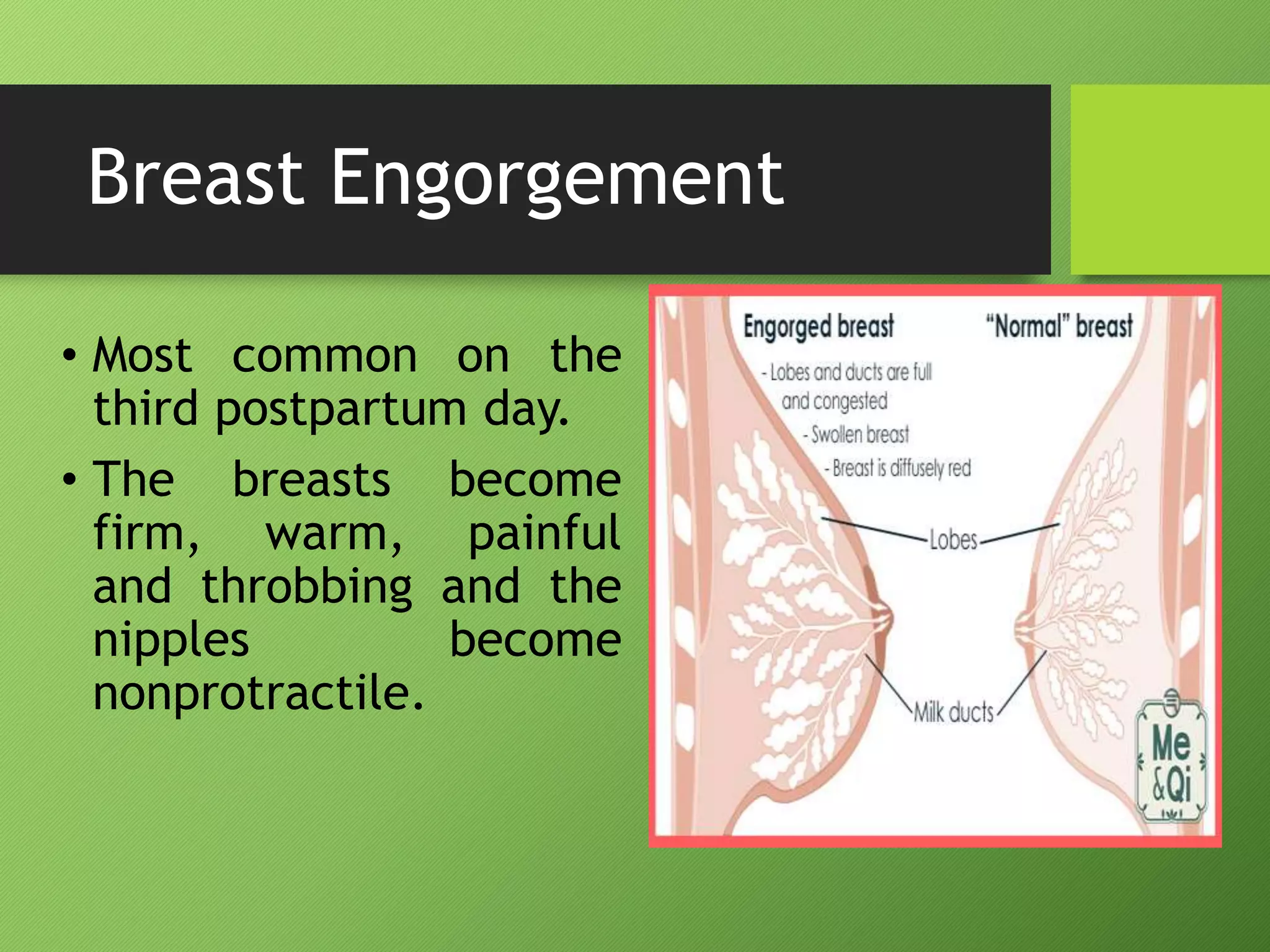 Breast Engorgement
• Most common on the
third postpartum day.
• The breasts become
firm, warm, painful
and throbbing and the
nipples become
nonprotractile.
 