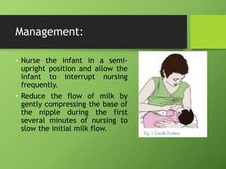 Management:
• Nurse the infant in a semi-
upright position and allow the
infant to interrupt nursing
frequently.
• Reduce the flow of milk by
gently compressing the base of
the nipple during the first
several minutes of nursing to
slow the initial milk flow.
 