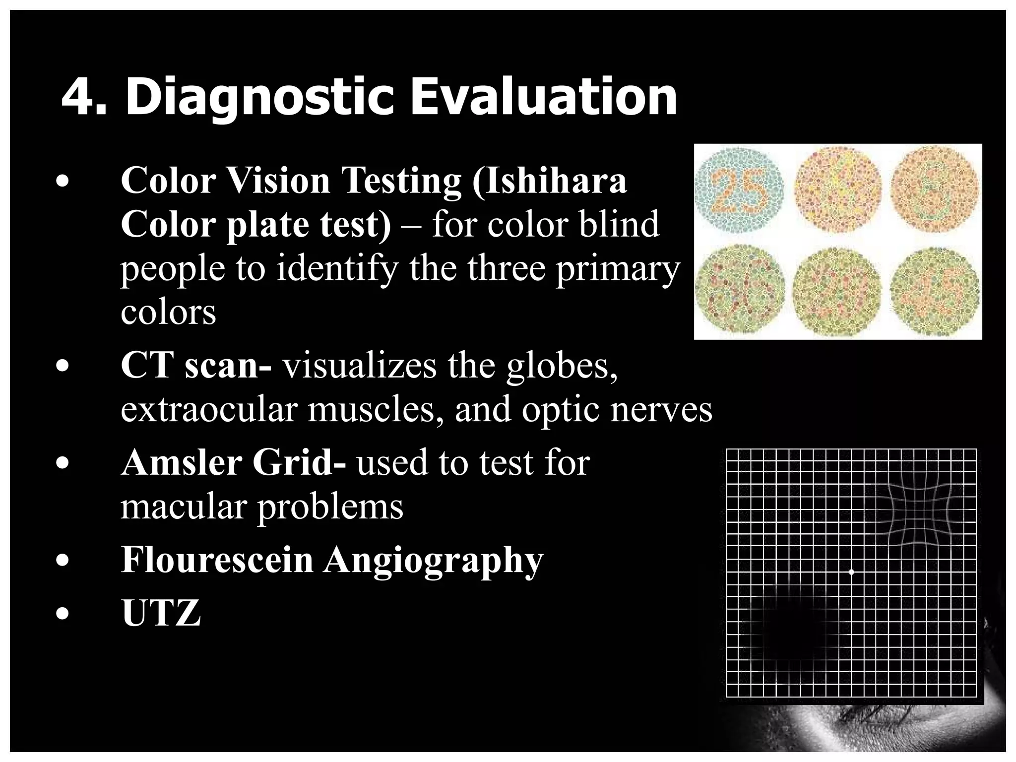 4. Diagnostic Evaluation  Color Vision Testing (Ishihara Color plate test)  – for color blind people to identify the three primary colors CT scan-  visualizes the globes, extraocular muscles, and optic nerves Amsler Grid-  used to test for macular problems  Flourescein Angiography UTZ 