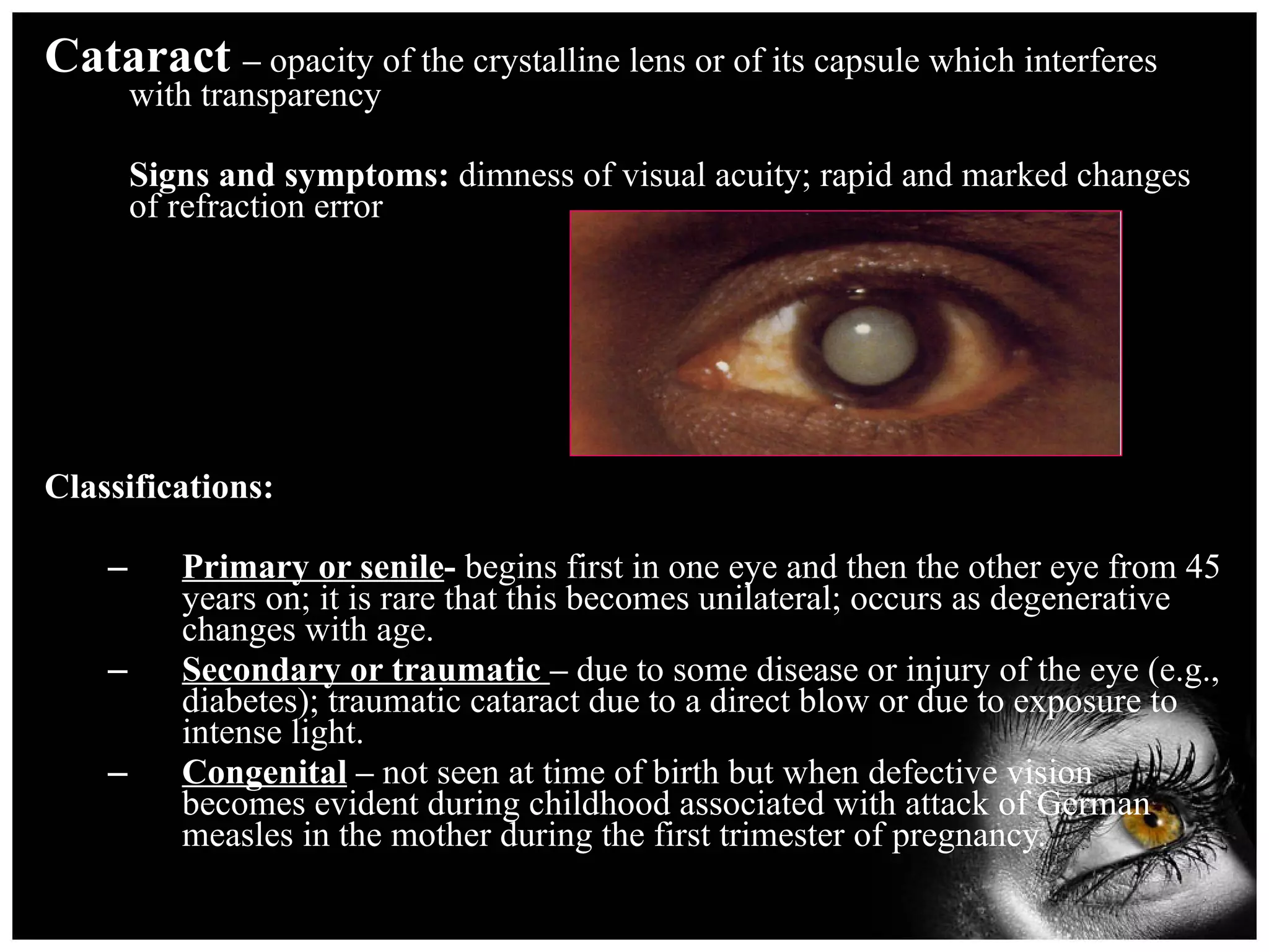 Cataract  –  opacity of the crystalline lens or of its capsule which interferes with transparency Signs and symptoms:  dimness of visual acuity; rapid and marked changes of refraction error Classifications: Primary or senile -  begins first in one eye and then the other eye from 45 years on; it is rare that this becomes unilateral; occurs as degenerative changes with age. Secondary or traumatic  –  due to some disease or injury of the eye (e.g., diabetes); traumatic cataract due to a direct blow or due to exposure to intense light. Congenital  –  not seen at time of birth but when defective vision becomes evident during childhood associated with attack of German measles in the mother during the first trimester of pregnancy. 