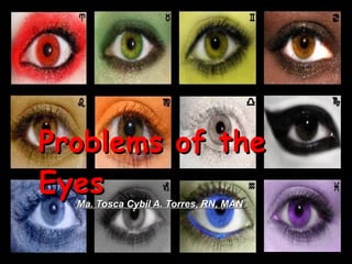 Problems of the Eyes Ma. Tosca Cybil A. Torres, RN, MAN 
