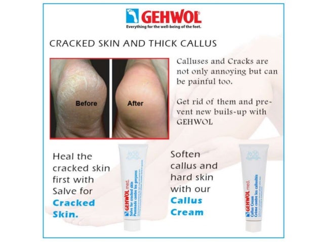 GEHWOL Problem solver