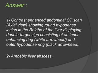 Problem solving : a quiz in general surgerypptx | PPTX