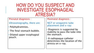 HOW DO YOU SUSPECT AND
INVESTIGATE ESOPHAGEAL
ATRESIA?
Prenatal diagnosis :
Ultrasonography, there are:
• Polyhydramnios.
• The fetal stomach bubble.
• Dilated upper esophageal
pouch.
Postnatal diagnosis :
NGT or orogastric tube
placement and x-ray:
• Diagnosis is suggested by
inability to pass the tube into
the stomach.
• A radiopaque catheter
determines the location of the
atresia on x-ray.
 