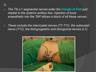 2-
 The T6–L1 segmental nerves enter the triangle of Petit just
medial to the anterior axillary line. Injection of local
anaesthetic into the TAP allows a block of all these nerves.
 These include the intercostal nerves (T7-T11), the subcostal
nerve (T12), the iliohypogastric and ilioinguinal nerves (L1).
 