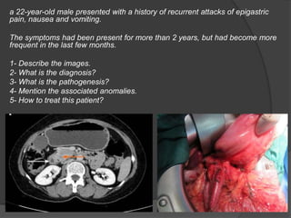 a 22-year-old male presented with a history of recurrent attacks of epigastric
pain, nausea and vomiting.
The symptoms had been present for more than 2 years, but had become more
frequent in the last few months.
1- Describe the images.
2- What is the diagnosis?
3- What is the pathogenesis?
4- Mention the associated anomalies.
5- How to treat this patient?
 