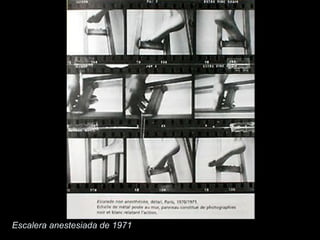 Escalera anestesiada de 1971
 