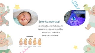 Procedimentos de Enfermagem em UTI Neonatal - Unidade Neonatal..pptx