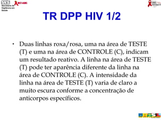 Duas linhas roxa/rosa, uma na área de TESTE (T) e uma na área de CONTROLE (C), indicam um resultado reativo. A linha na área de TESTE (T) pode ter aparência diferente da linha na área de CONTROLE (C). A intensidade da linha na área de TESTE (T) varia de claro a muito escura conforme a concentração de anticorpos específicos. TR DPP HIV 1/2 