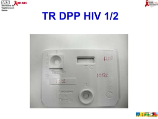 TR DPP HIV 1/2 