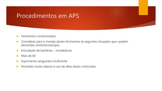 Procedimentos em APS
 Ferimentos contaminados
 Considerar para o manejo destes ferimentos as seguintes situações que~podem
demandar antibioticoterapia :
 Inoculação de bactérias – mordeduras
 Mais de 6h
 Suprimento sanguíneo insuficiente
 Pacientes muito obesos e uso de altas doses corticoides
 