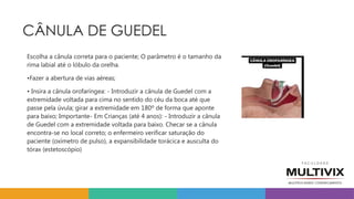 CÂNULA DE GUEDEL
Escolha a cânula correta para o paciente; O parâmetro é o tamanho da
rima labial até o lóbulo da orelha.
•Fazer a abertura de vias aéreas;
• Insira a cânula orofaríngea: - Introduzir a cânula de Guedel com a
extremidade voltada para cima no sentido do céu da boca até que
passe pela úvula; girar a extremidade em 180º de forma que aponte
para baixo; Importante- Em Crianças (até 4 anos): - Introduzir a cânula
de Guedel com a extremidade voltada para baixo. Checar se a cânula
encontra-se no local correto; o enfermeiro verificar saturação do
paciente (oxímetro de pulso), a expansibilidade torácica e ausculta do
tórax (estetoscópio)
 