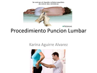 Procedimiento Puncion Lumbar

      Karina Aguirre Alvarez
 