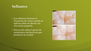 Sellantes
• Los sellantes detienen la
formación de caries cuando se
aplican sobre un diente con
una caries pequeña.

• Esta acción sella el aporte de
nutrientes a las bacterias que
producen la cavidad

 