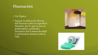Fluoración
• Vía Tópica:

• Supone la aplicación directa
del fluoruro sobre la superficie
dentaria, por lo que su uso es
posteruptivo, pudiendo
iniciarse a los 6 meses de edad
y continuarse durante toda la
vida.

 