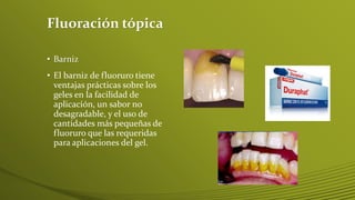 Fluoración tópica
• Barniz

• El barniz de fluoruro tiene
ventajas prácticas sobre los
geles en la facilidad de
aplicación, un sabor no
desagradable, y el uso de
cantidades más pequeñas de
fluoruro que las requeridas
para aplicaciones del gel.

 