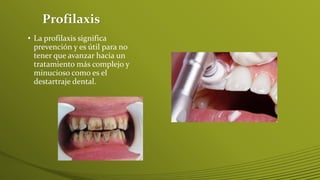 Profilaxis
• La profilaxis significa
prevención y es útil para no
tener que avanzar hacia un
tratamiento más complejo y
minucioso como es el
destartraje dental.

 