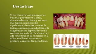 Destartraje
• Si por el contrario dejamos que las
bacterias presentes en la placa,
desmineralicen al diente y lo tornen
más rugoso, veremos como
rápidamente el esmalte se cubre de
tártaro, aumentando gradualmente la
carga bacteriana depositada y con la
conjunta acumulación de alimentos y
alta concentración de minerales en la
saliva, nos llevará lentamente a
producir la enfermedad periodontal.

 