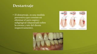 Destartraje
• El destartraje, es una medida
preventiva que consiste en
eliminar el sarro supra y
subgingival (depositado sobre
la corona y raíz del diente
respectivamente),

 