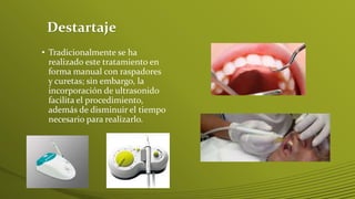 Destartaje
• Tradicionalmente se ha
realizado este tratamiento en
forma manual con raspadores
y curetas; sin embargo, la
incorporación de ultrasonido
facilita el procedimiento,
además de disminuir el tiempo
necesario para realizarlo.

 