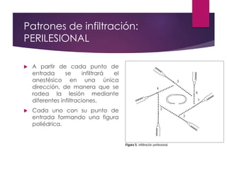 Perilesional Injection Procedimientos de anestesia local | PPTX