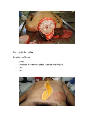 Necropsia de cuello:
Incisiones cutáneas:
- Media
- Lateral de mandíbula y borde superior de clavículas.
- En Y
- En T
 
