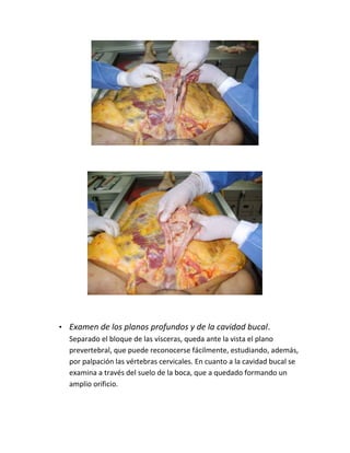• Examen de los planos profundos y de la cavidad bucal.
Separado el bloque de las vísceras, queda ante la vista el plano
prevertebral, que puede reconocerse fácilmente, estudiando, además,
por palpación las vértebras cervicales. En cuanto a la cavidad bucal se
examina a través del suelo de la boca, que a quedado formando un
amplio orificio.
 