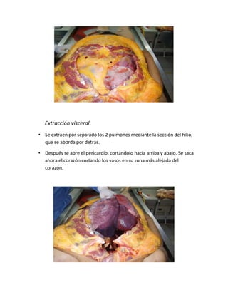 Extracción visceral.
• Se extraen por separado los 2 pulmones mediante la sección del hilio,
que se aborda por detrás.
• Después se abre el pericardio, cortándolo hacia arriba y abajo. Se saca
ahora el corazón cortando los vasos en su zona más alejada del
corazón.
 