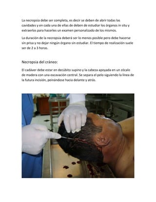 La necropsia debe ser completa, es decir se deben de abrir todas las
cavidades y en cada una de ellas de deben de estudiar los órganos in situ y
extraerlos para hacerles un examen personalizado de los mismos.
La duración de la necropsia deberá ser lo menos posible pero debe hacerse
sin prisa y no dejar ningún órgano sin estudiar. El tiempo de realización suele
ser de 2 a 3 horas.
Necropsia del cráneo:
El cadáver debe estar en decúbito supino y la cabeza apoyada en un zócalo
de madera con una excavación central. Se separa el pelo siguiendo la línea de
la futura incisión, peinándose hacia delante y atrás.
 