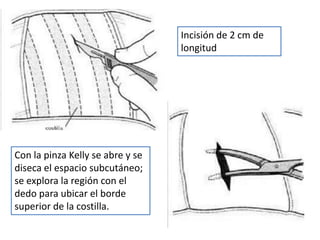 Procedimientos de emergencia | PPT