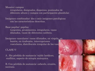 Se introduce un espéculo (sin lubricante) en la vagina. 