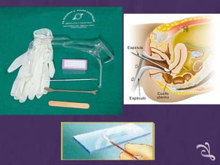 LEGRADO UTERINO Procedimiento diagnóstico y/o terapéutico, por medio del cual se extrae la capa funcional del endometrio y/o restos de membranas ovulares o placentarios, se realiza bajo anestesia local o general según el criterio del especialista.Preferiblemente, se acompaña de biopsia.INDICACIONES:Neoplasias endometriales, benignas o malignas