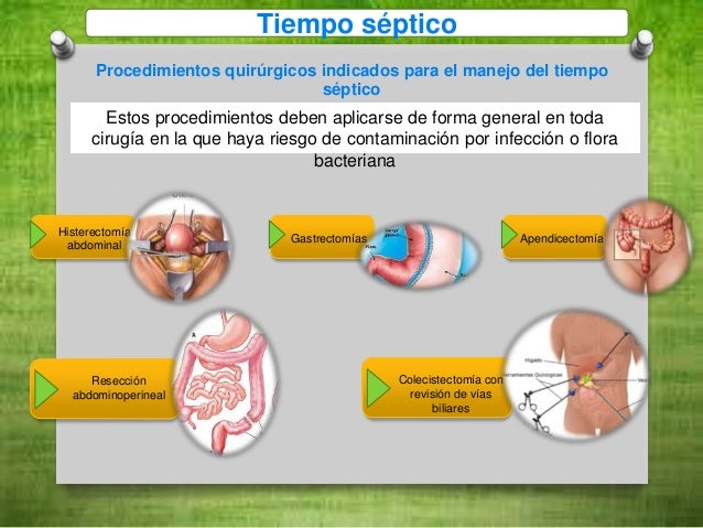 Procedimientos especiales sala quirurgica