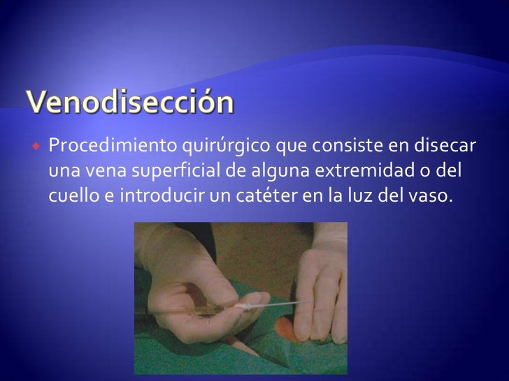 VENODISECCION TECNICA QUIRURGICA PDF DOWNLOAD